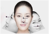 Nâng mũi bán cấu trúc có vĩnh viễn không?