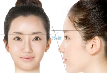 Thế nào là mũi chuẩn tỷ lệ vàng?