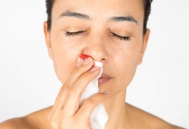 Dấu hiệu nâng mũi bị viêm