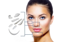 Nâng mũi cấu trúc surgiform là gì?