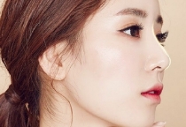 Nâng mũi cấu trúc có an toàn không?