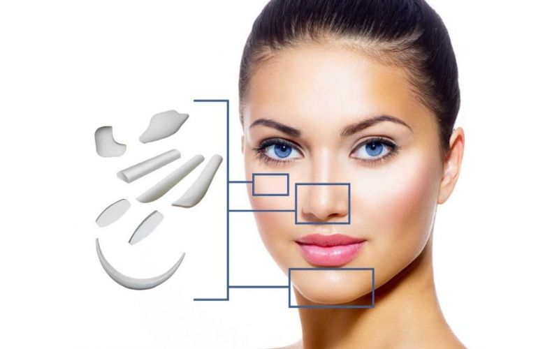 Nâng mũi cấu trúc surgiform là gì?