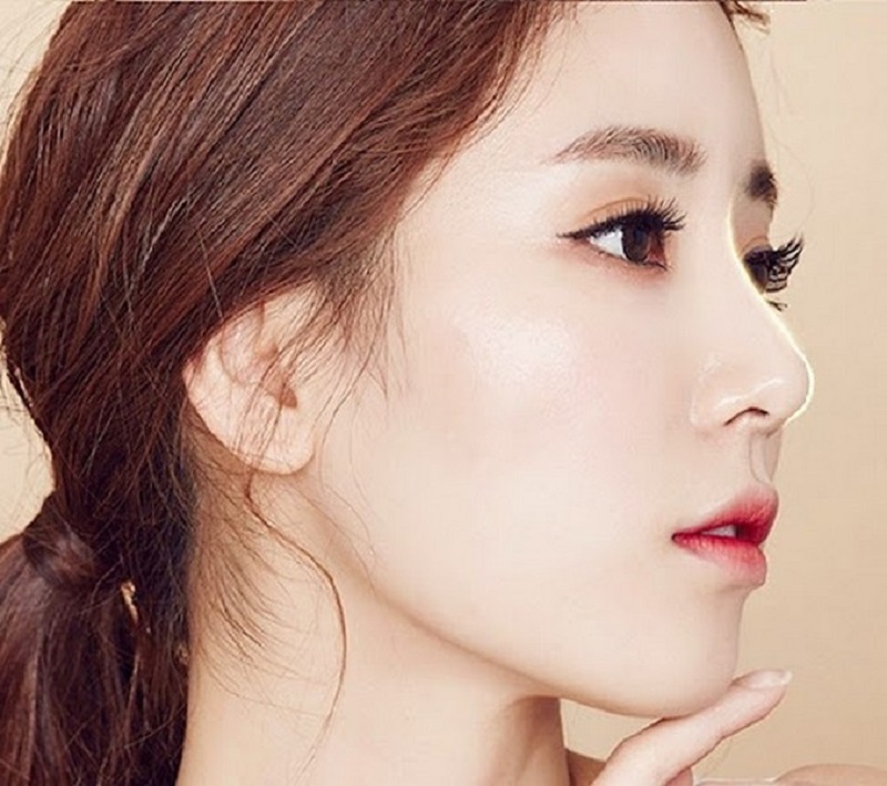 Nâng mũi cấu trúc có an toàn không?