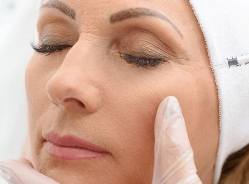 Nâng mũi cấu trúc có tháo ra được không?